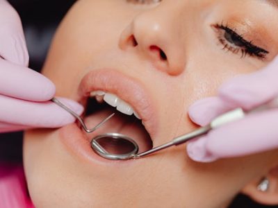 Dental Treatments